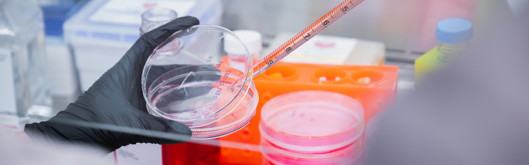 lab worker putting a sample on a petri dish