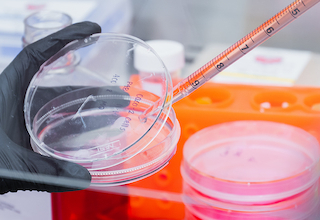 lab worker putting a sample on a petri dish