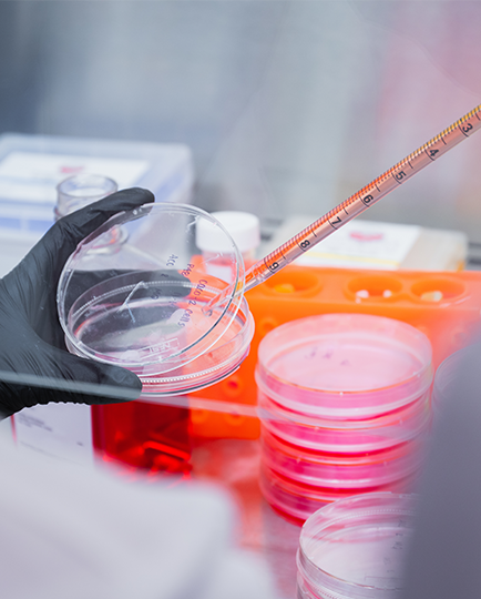 lab worker putting a sample on a petri dish